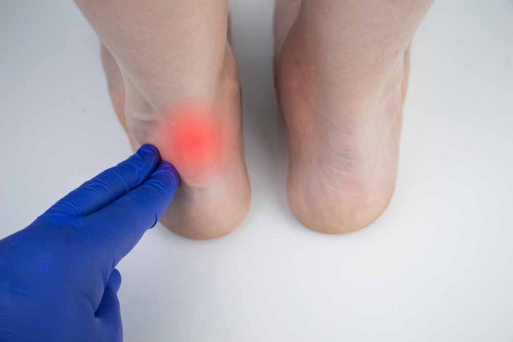 achilles tendonitis vs tendinosis